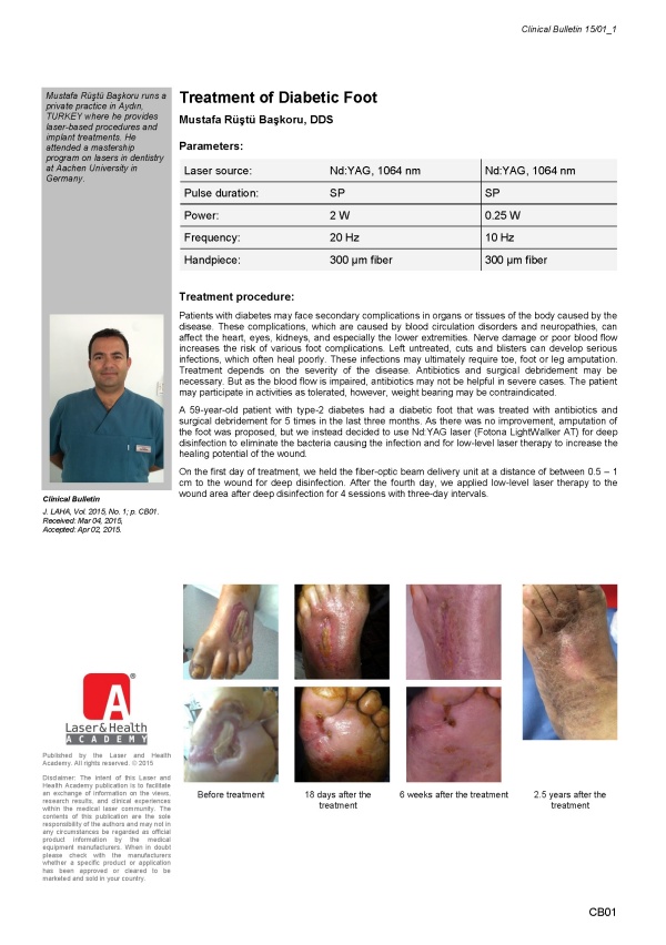Treatment of Diabetic Foot
