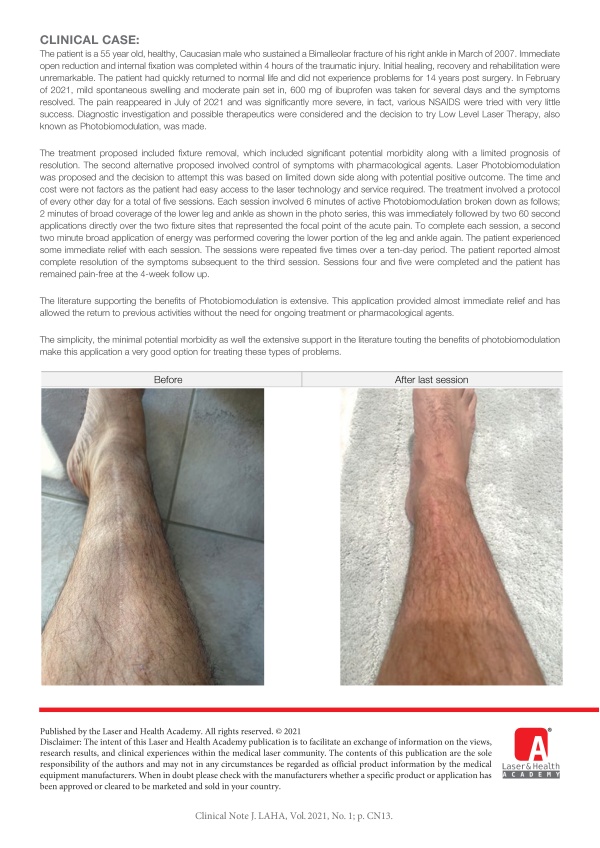 The Potential Benefit of PBM in the Treatment of a Late Post-operative Complication Subsequent to Open Reduction with Internal Fixation of Ankle Fractures