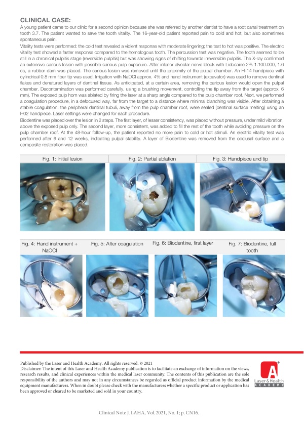 Vitality Preservation in Teeth with Extensive Carious Lesions