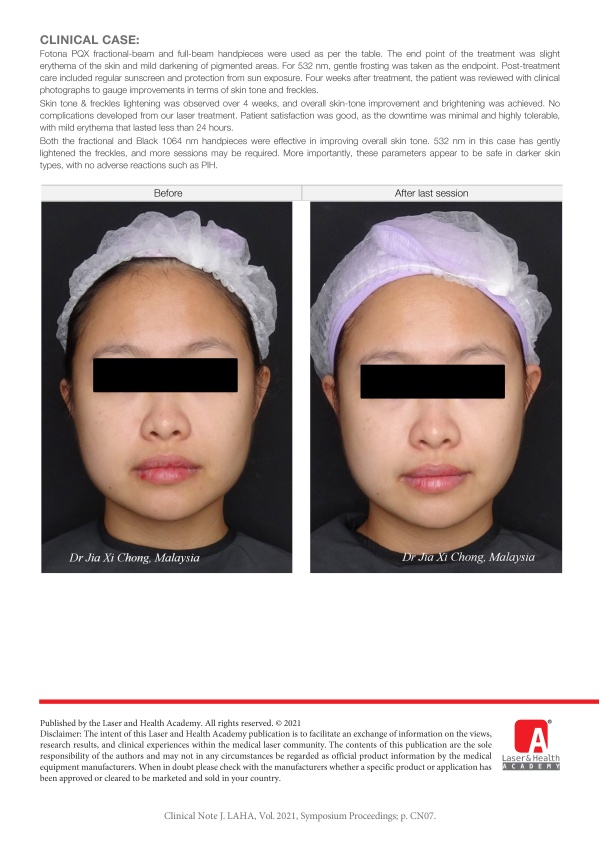 Asian Skin Rejuvenation with Pico Laser