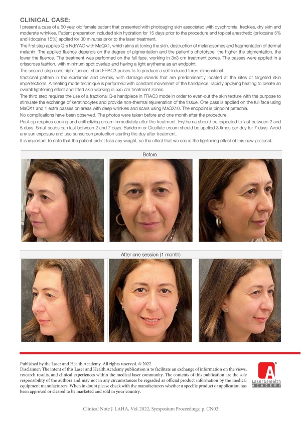One-Session Facial Rejuvenation and Toning with the StarWalker MaQX Laser