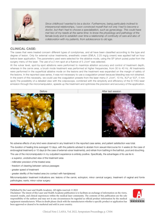 Advantages of Outpatient Treatment of Vulvar Lesions with Erbium Laser and Micromanipulator