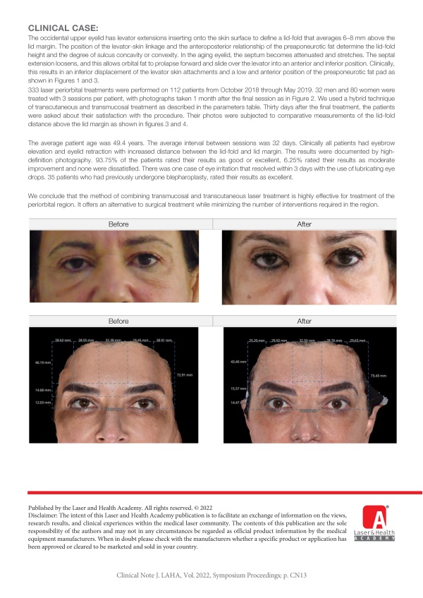 Transmucosal and Transcutaneous Combination Treatment of Periorbital Region with Erbium:YAG Laser