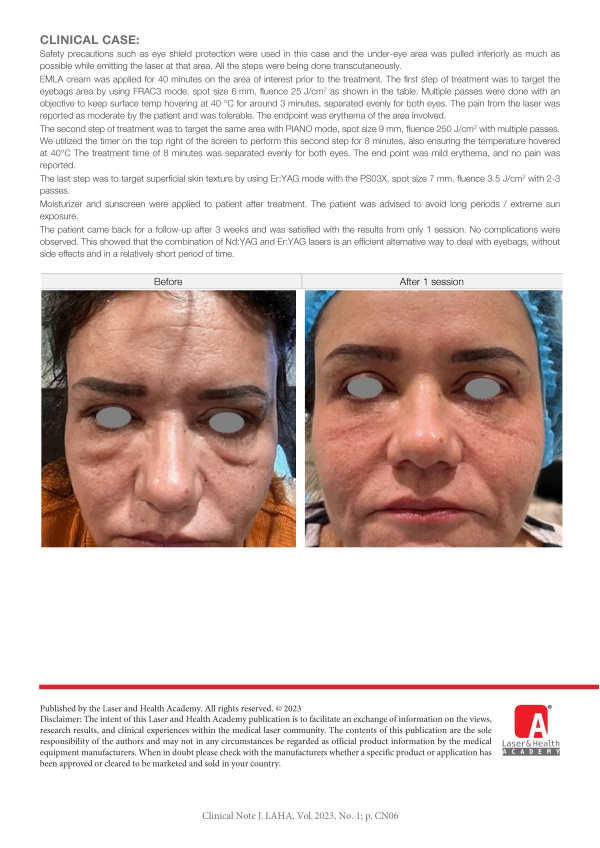 Effective Non-surgical Treatment with Nd:YAG and Er:YAG Lasers for Lower Eyelid Dermatochalasis and Eyebags