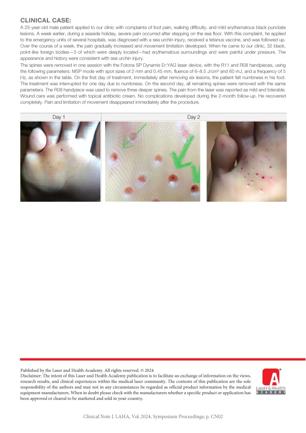 Treatment of Sea Urchin Injury on the Sole of the Foot with Er:YAG Laser