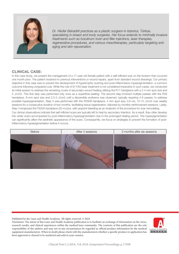 Early Treatment of Self-inflicted Forearm Scars