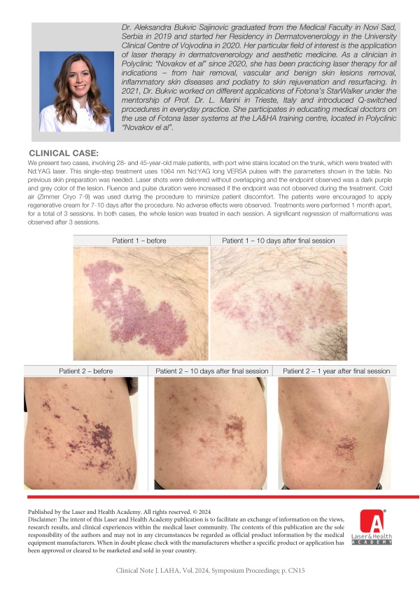 Nd:YAG Laser Therapy for Port Wine Stain – Two Case Reports
