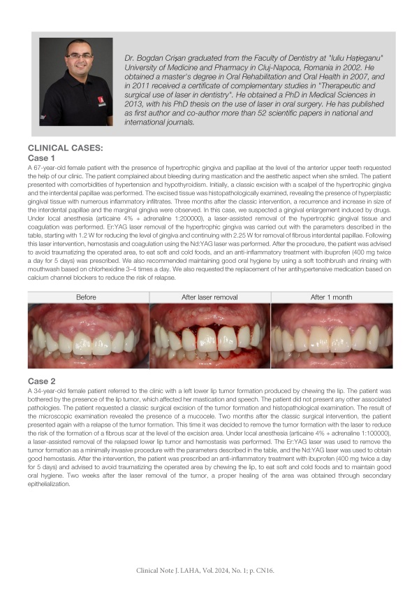 Oral Soft-Tissue Management with a LightWalker Laser
