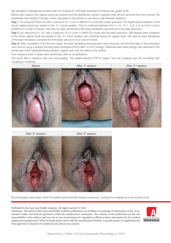 Total Prolapse Management by 2940 nm Er:YAG Laser