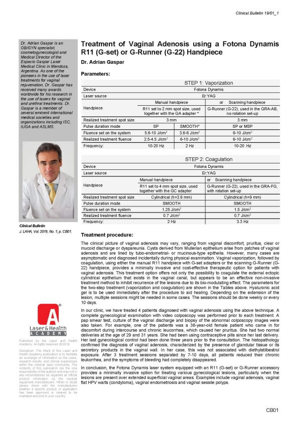 Treatment of Vaginal Adenosis using a Fotona Dynamis R11 (G-set) or G-Runner (G-22) Handpiece