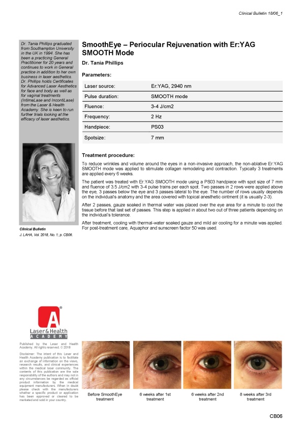 SmoothEye – Periocular Rejuvenation with Er:YAG SMOOTH Mode