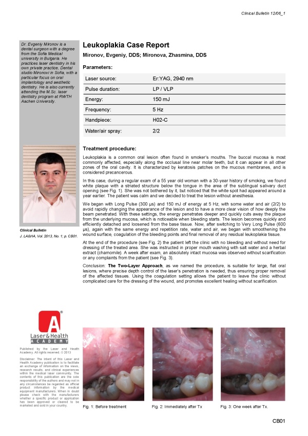 Leukoplakia Case Note