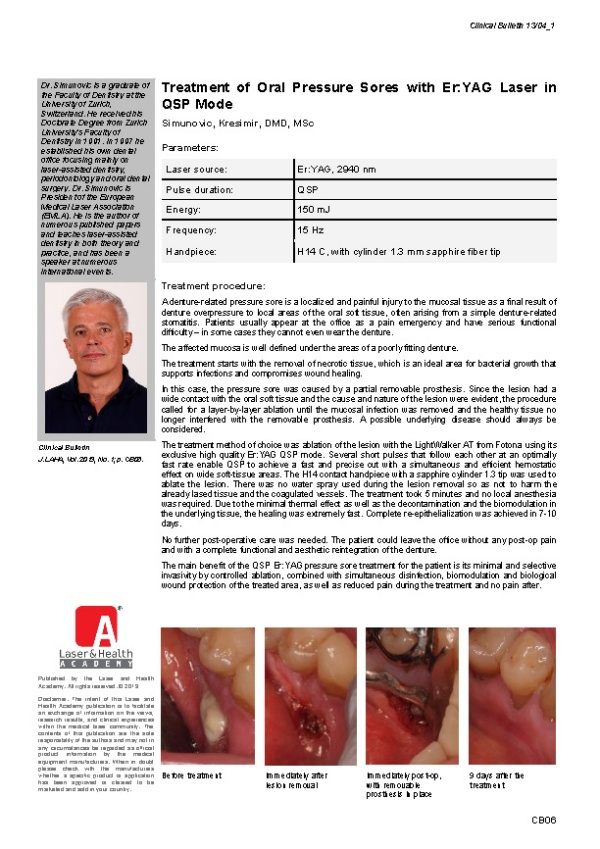 Treatment of Oral Pressure Sores with Er:YAG Laser in QSP Mode